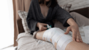 ACL手術後の女性