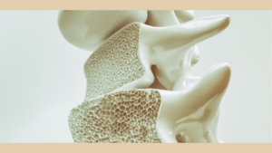 骨粗鬆症の骨