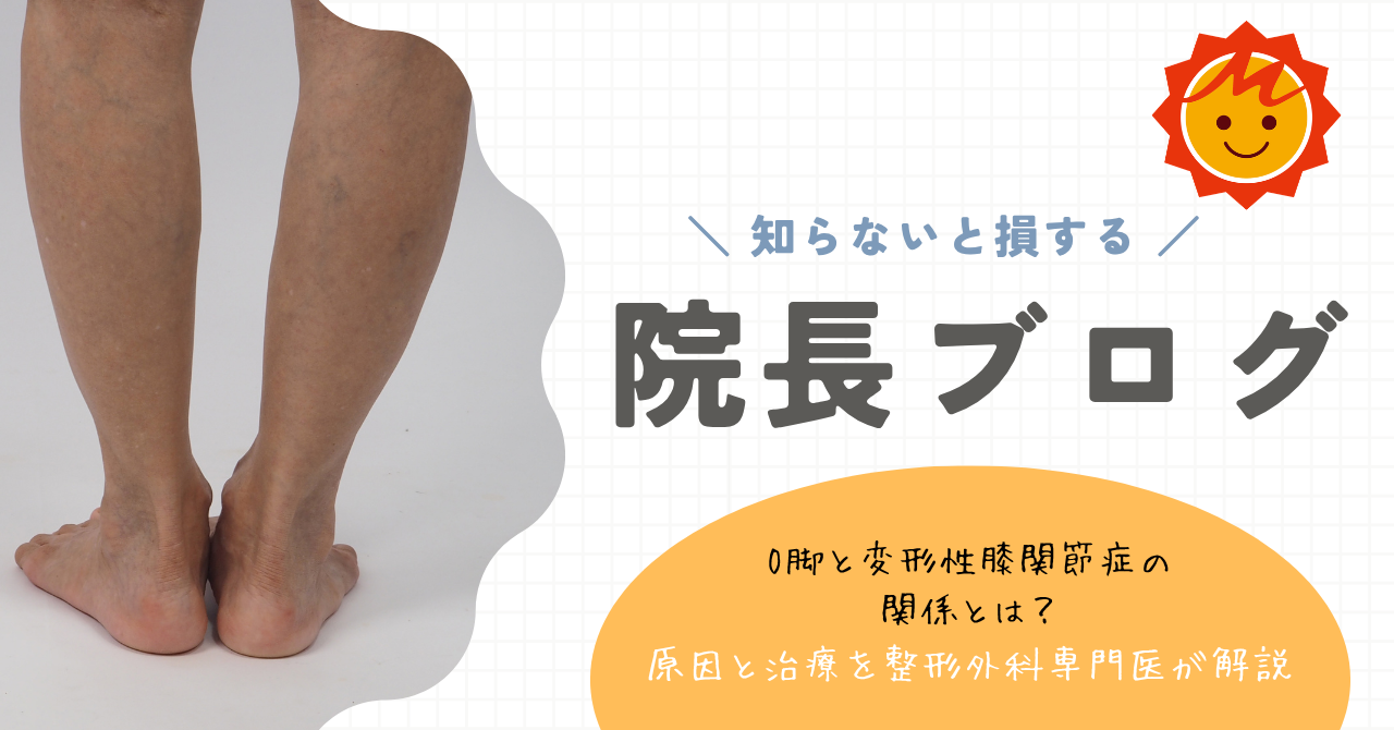 【久留米市の整形外科】O脚と変形性膝関節症の関係とは？原因と治療を整形外科専門医が解説